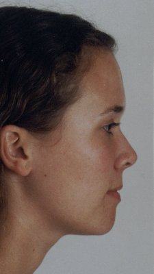 Perfil 2